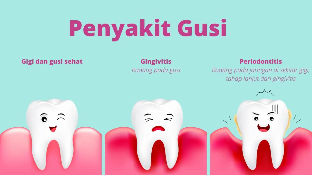 Tak Cukup Sikat Gigi: Pola Makan Sehat Jadi Kunci Gusi Kuat dan Bebas Penyakit