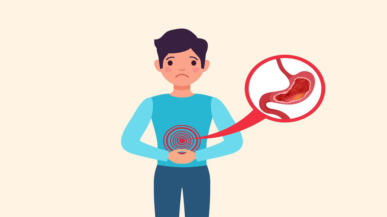 GERD Ramai Dibicarakan, Dokter Tegaskan Tidak Sebabkan Kematian Mendadak