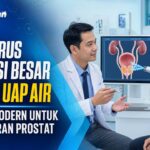 Tak Harus Operasi Besar, Terapi Uap Air Jadi Pilihan Modern untuk Mengatasi Pembesaran Prostat