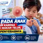 Bisul pada Anak Bukan karena Banyak Makan Telur, Kenali Penyebabnya