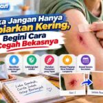 Luka Jangan Hanya Dibiarkan Kering, Begini Cara Cegah Bekasnya